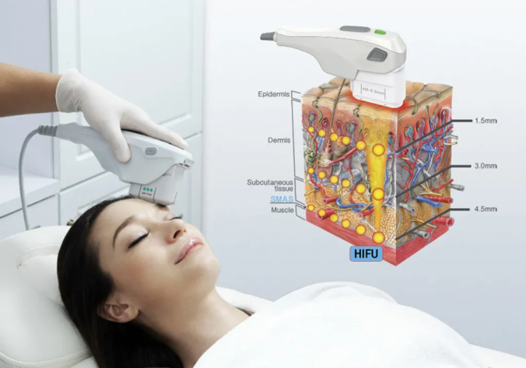 [Bangkok] Ultherapy & HIFU Treatments